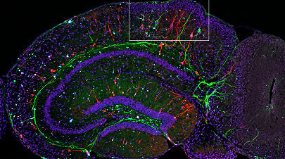 Microplastics in the Brain: What the New 2026 Nature Study Means for Your Health